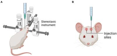 Routes of administration for adeno-associated viruses carrying gene therapies for brain diseases